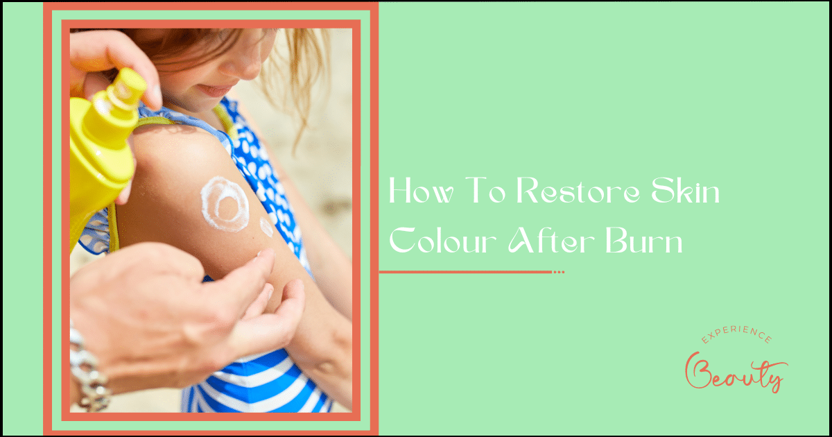 Read more about the article How To Restore Skin Colour After Burn