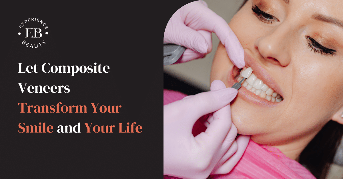 Composite Veneers Transform smile and ifte Banner Image - Young man at the dentist's chair during a dental procedure. Overview of dental caries prevention.